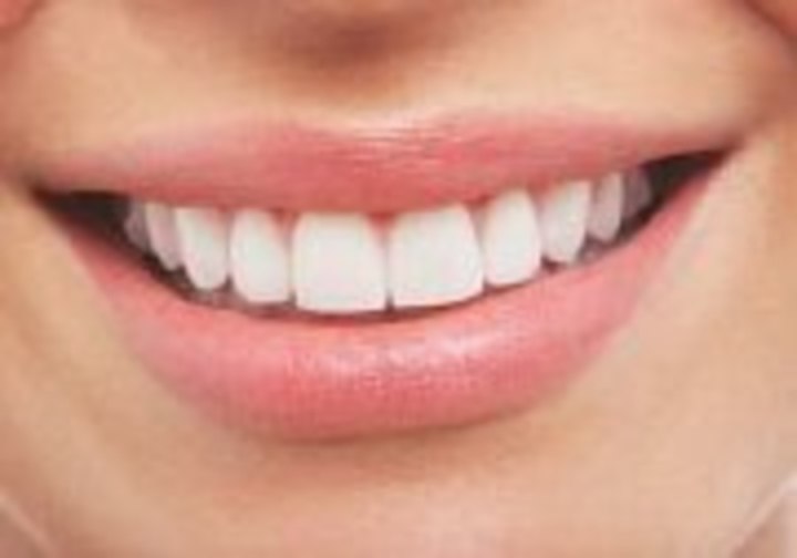 улыбка показывающая красивые зубы